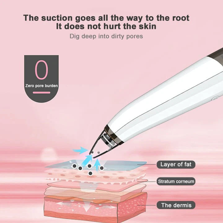 Acne Pore Cleaner & Black Head Remover